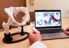 A impressão 3D revoluciona procedimentos na ortopedia oncológica