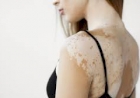Vitiligo: doença não tem cura, mas opções de tratamento podem impedir sua evolução.