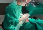 Primeiro transplante capilar realizado na Unimed Erechim tem dez horas de duração e mais de 10 mil fios implantados