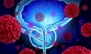 Câncer de próstata: na Região Sul do país, RS lidera em número de casos e PR, em crescimento, na comparação entre os anos 2022 e 2021