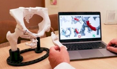 A impressão 3D revoluciona procedimentos na ortopedia oncológica
