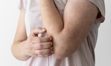 Hanseníase: sintomas iniciais podem ser confundidos com outras doenças