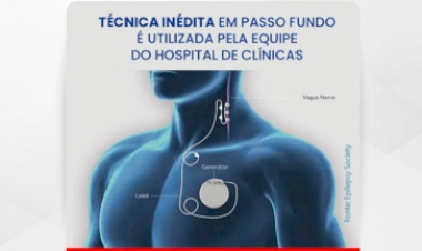 Técnica inédita em Passo Fundo é utilizada pela equipe do Hospital de Clínicas para tratamento de epilepsia refratária