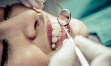 UNIDEAU oferece exame gratuito em alusão ao Maio Vermelho, mês da conscientização do câncer bucal