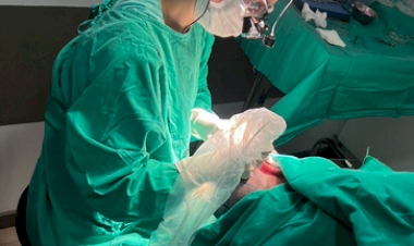 Primeiro transplante capilar realizado na Unimed Erechim tem dez horas de duração e mais de 10 mil fios implantados