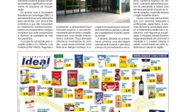 Hospital da Unimed Erechim realiza sua primeira pericardiectomia