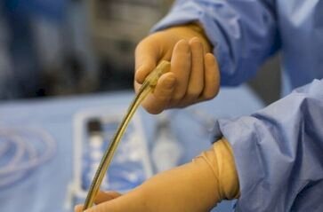 Implante de esfíncter urinário artificial é realizado pela primeira vez no Hospital de Clínicas