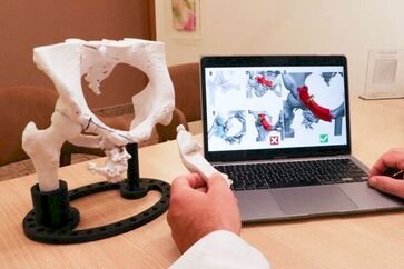 A impressão 3D revoluciona procedimentos na ortopedia oncológica