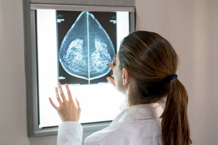 Mamografia pelo SUS a partir dos 40 anos já está valendo